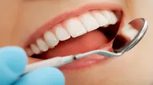 علائم اولیه پوسیدگی دندان در کودکان