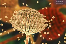 تأیید FDA برای داروی Zolbetuximab در سرطان پیشرفته معده