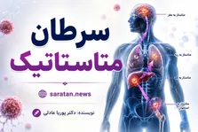کشف جدید دانشمندان درباره متاستاز سرطان ریه