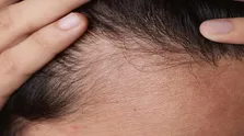 آیا خوابیدن روی شکم مضر است؟