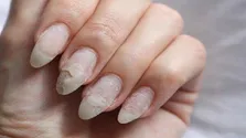 علائمی که خبر از کمبود می‌دهند