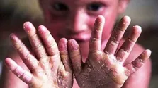 سهم دولت از تأمین هزینه های درمانی مردم