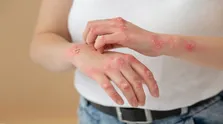 کووید ۱۹ احتمال ابتلا به مشکلات گوارشی بلند مدت را افزایش می دهد