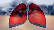 هر نخ سیگار چند دقیقه طول عمر را کم می‌کند؟