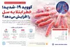کووید شدید ممکن است خطر ابتلا به سل را افزایش دهد