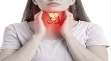 علت به هم چسبیدگی برخی دوقلوها چیست و چقدر امکان جداسازی آنها وجود دارد؟