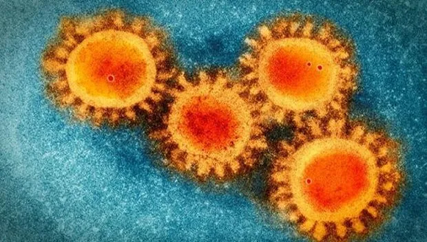 افزایش احتمال ابتلا به کووید ۱۹ در افراد HIV