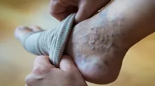 عدم تناسب بین اهدا و درخواست خون در تهران / فعالیت مراکز اهدای خون پایتخت بعد از افطار