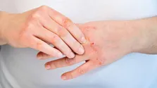 ورزش زودهنگام پس از سکته مغزی به حفظ مهارت‌های فکری کمک می‌کند