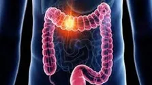 استفاده از دستکش ضدویروس هیچ جایگاه علمی در کنترل عفونت ندارد