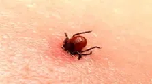 چگونه از بوی بد دهان خلاص شویم