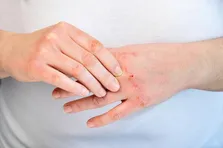 بدبینی در اسکن مغزی نمایان می‌شود