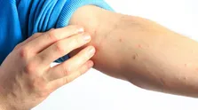 لرزش دست ها شایع ترین علامت پارکینسون