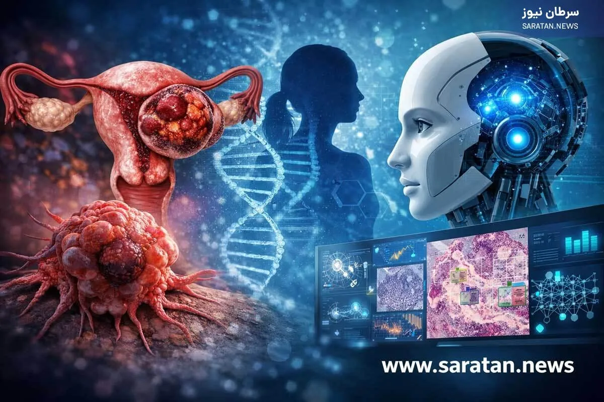 نقش آندومتریوز در سرطان تخمدان و افق‌های تشخیصی با هوش مصنوعی