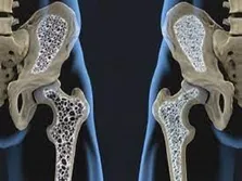 ترس از جراحی، عاملی برای انکار کیست پستان