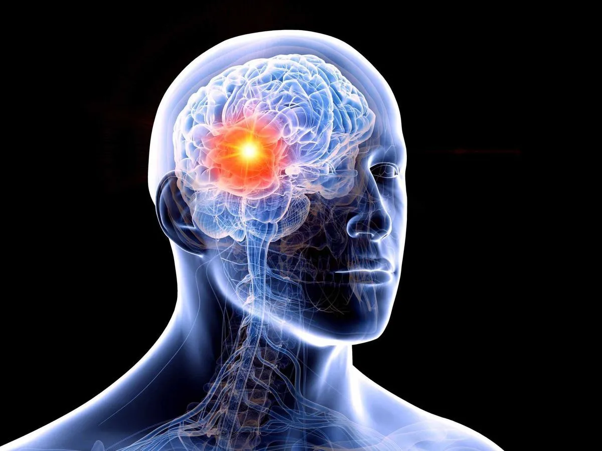 شناسایی زودهنگام سرطان مغز و پروستات با MRI نانویی