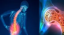 افزایش مرگ و میرهای مرتبط با اُزن در جهان