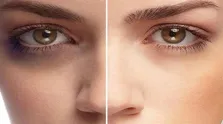 کم خوابی و بد خوابی چه بلایی سر مغز می‌آورد؟