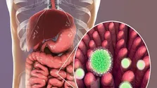 علل بروز اسهال در کودکان و راهکار‌های پیشگیری