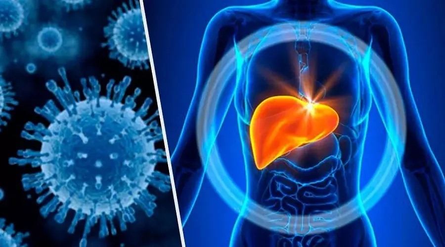 آیا هپاتیت سی موجب ابتلا به سرطان کبد می‌شود؟