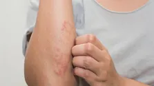 طراحی روشی برای تشخیصی سریع نوعی بیماری مشترک انسان و دام