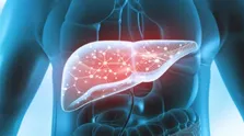 مقاومت اولیه به ایمونوتراپی در بیماران مبتلا به سرطان متاستاتیک دستگاه گوارش