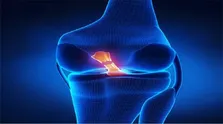 پرداخت خسارت بابت اختلال در سامانه نسخه الکترونیک