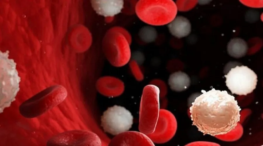 شایع‌ ترین علائم سرطان خون