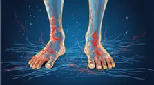 سندرم ناخن زرد چیست؟