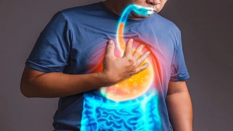 ریفلاکس مزمن باعث سرطان مری می شود؟