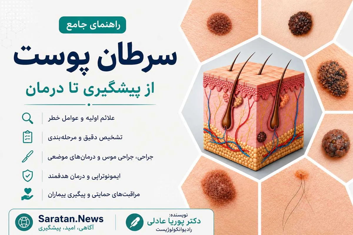 سرطان پوست چیست؟ علائم، علل، تشخیص و جدیدترین روش‌های درمان سرطان پوست
