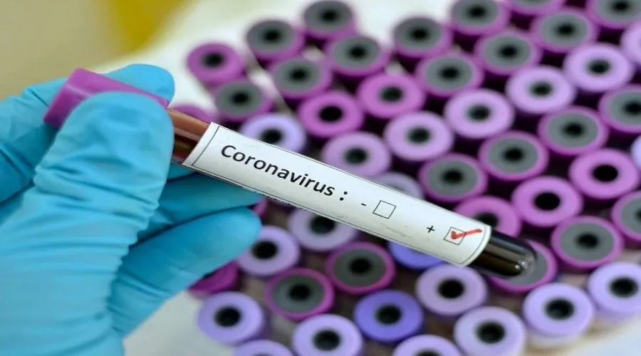 آخرین وضعیت کرونا در کشور/ یک فوتی و شناسایی ۴۲ ابتلای جدید