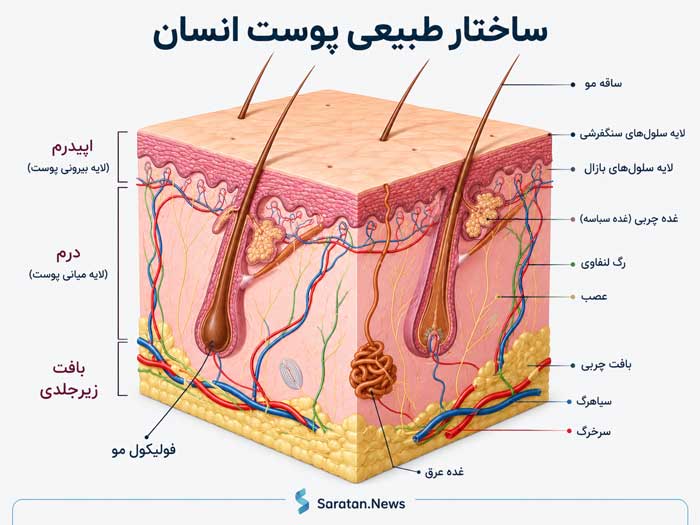 شکل ۱. آناتومی پوست؛ نمایی از لایههای مختلف پوست شامل اپیدرم (لایه سلولهای سنگفرشی و لایه سلولهای بازال)، درم، بافت زیرجلدی و سایر ساختارهای پوست. شکل ۱. آناتومی پوست؛ نمایی از لایههای مختلف پوست شامل اپیدرم (لایه سلولهای سنگفرشی و لایه سلولهای بازال)، درم، بافت زیرجلدی و سایر ساختارهای پوست.