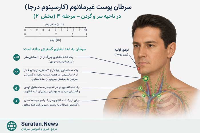 سرطان پوست چیست؟ علائم، علل، تشخیص و جدیدترین روشهای درمان سرطان پوست سرطان پوست چیست؟ علائم، علل، تشخیص و جدیدترین روشهای درمان سرطان پوست