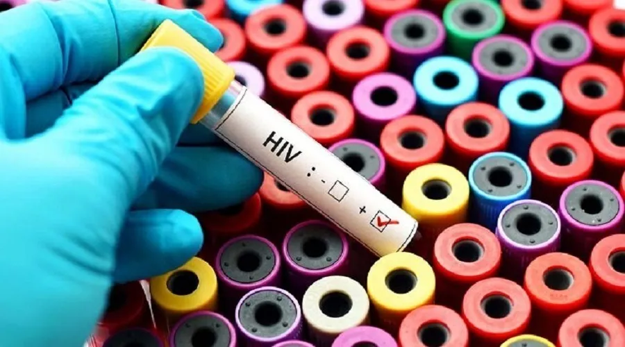 رویکرد وزارت بهداشت در شناسایی و درمان مبتلایان HIV/ اهمیت مصرف مداوم دارو در بیماران