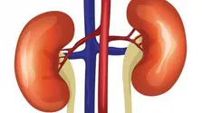 چگونه از پیشرفت بیماری‌های نهفته کلیه‌ها پیشگیری کنیم؟ + فیلم