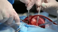آیا کهیر و سرطان خون ارتباطی به هم دارند؟