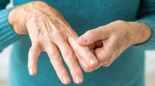 عارضه‌های زیاده روی در رنگ کردن مو/ کراتینه چه مضراتی دارد