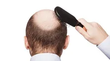 تنور داغ تبلیغات کاهش وزن تا عید
