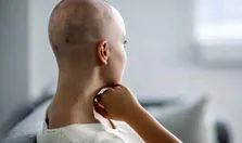نقش قند در خطر ابتلا به سرطان چقدر است؟