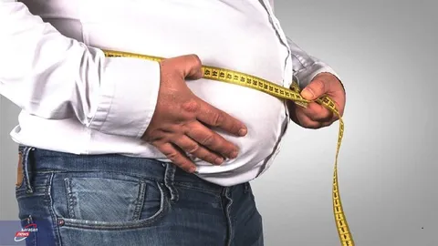 چاقی دومین علت ایجاد سنگ صفرا در دنیا + فیلم