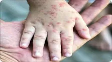ویروس‌های متقلب شدت آنفلوانزا را کاهش می‌دهند