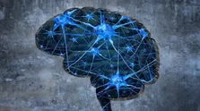 تشخیص ابتلا به آلزایمر با علامتی ساده