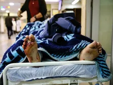 صافکاری و نقاشی بدن توسط جراحان قلابی‌