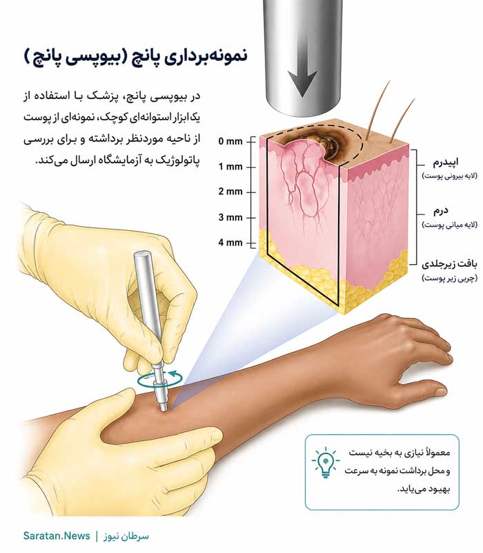 سرطان پوست چیست؟ علائم، علل، تشخیص و جدیدترین روشهای درمان سرطان پوست سرطان پوست چیست؟ علائم، علل، تشخیص و جدیدترین روشهای درمان سرطان پوست