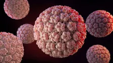 کنفرانس علمی HPV در بیمارستان لاله؛ از غربالگری و واکسیناسیون تا درمان ضایعات پیش‌سرطانی