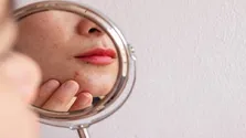 زبان سفید چه چیزی درباره سلامت می‌گوید؟