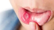 روشی برای کاهش خطر ابتلا به سرطان