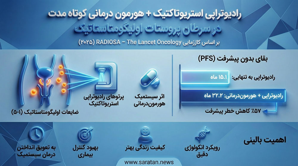 درمان جدید متاستاز پروستات با SBRT و هورمون‌درمانی
