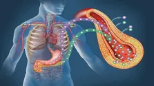 بوتاکس معده؛ روشی غیراستاندارد و پرعارضه برای کاهش وزن